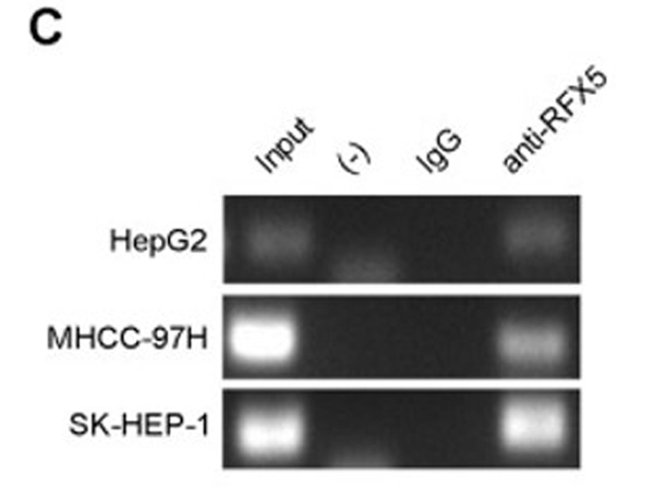 IP/WB using Rabbit IgG